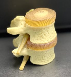 Normal healthy disc and vertebrae